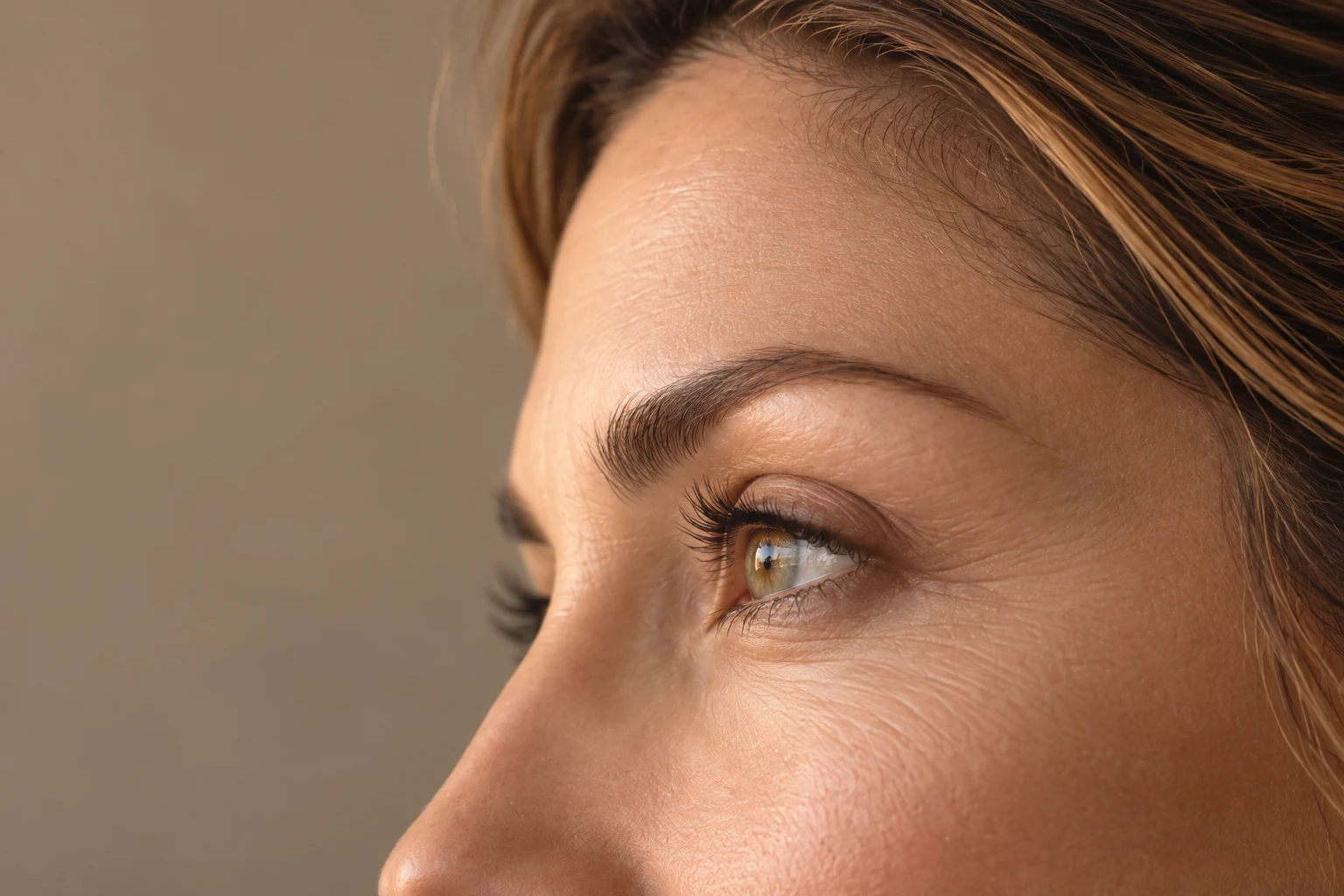 Temporal Lift — Subtle Opening of the Gaze and Rejuvenation of the Upper Third of the Face